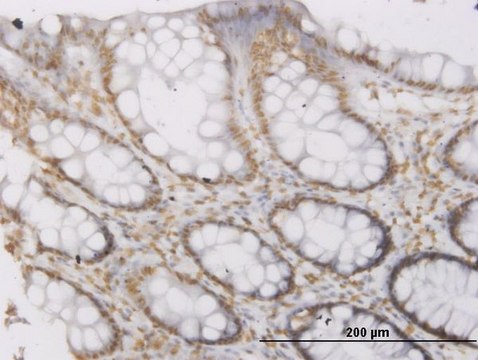 Monoclonal Anti-ROPN1 antibody produced in