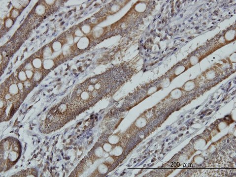 Monoclonal Anti-MRRF antibody produced in
