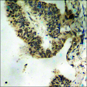 Anti-phospho-ATRIP (pSer??) antibody produced in