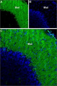 Anti-Calcium Channel CaV3.1 (?1G) antibody