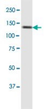 Monoclonal Anti-SMC6L1 antibody produced in