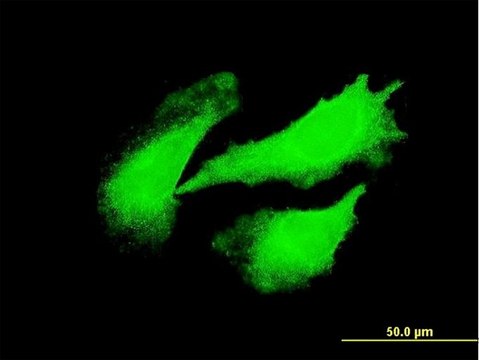 Monoclonal Anti-DYX1C1 antibody produced in