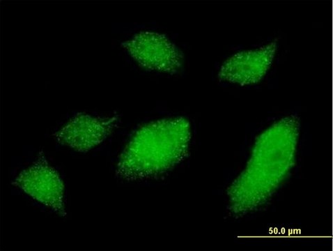 Monoclonal Anti-UBQLN1 antibody produced in