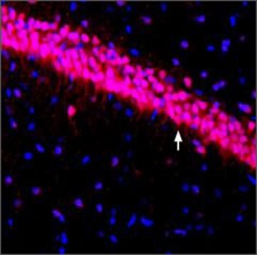 Anti-Potassium Channel K?4.3 antibody produced