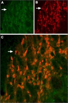 Anti-Potassium Channel K?11.2 (erg2) antibody
