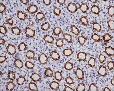 Anti-Water Channel Aquaporin 2 antibody