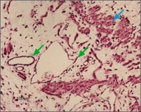 Anti-Potassium Channel KIR6.1 antibody produced