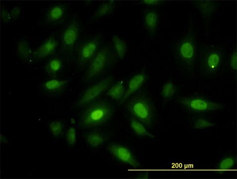 Monoclonal Anti-NEK10 antibody produced in