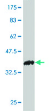 Monoclonal Anti-POMT2 antibody produced in