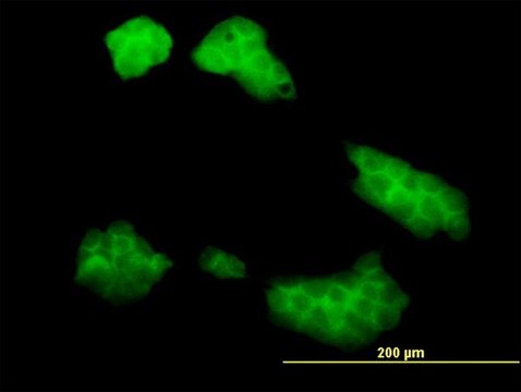Monoclonal Anti-UBE2Q2 antibody produced in